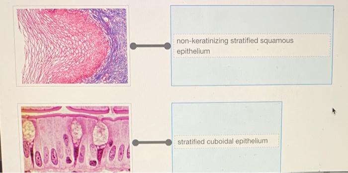 Epithelial tissue types characteristics classification epithelium notes scheme biology onlinebiologynotes