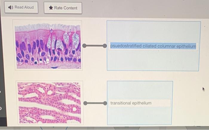 Rearrange the epithelium types to correspond to the correct image