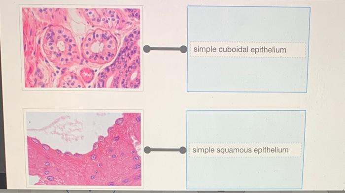 Rearrange the epithelium types to correspond to the correct image