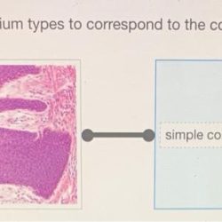 Epithelium functions characteristics definition follows subdivided