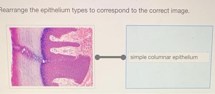 Epithelium functions characteristics definition follows subdivided