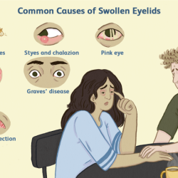 Eye eyelid swollen stye pain when blink upper why lid left styes socket chalazion blinking hurt inflammation corner eyes does